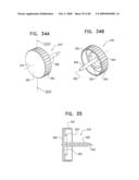 Injectable Intraocular Implants diagram and image