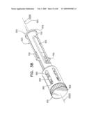 Injectable Intraocular Implants diagram and image