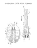 Injectable Intraocular Implants diagram and image