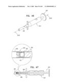 Injectable Intraocular Implants diagram and image