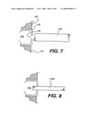 Method and Apparatus for the Treatment of the Intervertebral Disc Annulus diagram and image