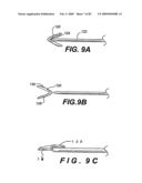 Method and Apparatus for the Treatment of the Intervertebral Disc Annulus diagram and image