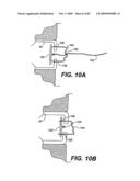 Method and Apparatus for the Treatment of the Intervertebral Disc Annulus diagram and image