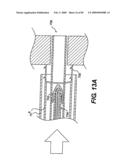 Method and Apparatus for the Treatment of the Intervertebral Disc Annulus diagram and image