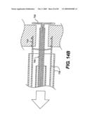 Method and Apparatus for the Treatment of the Intervertebral Disc Annulus diagram and image