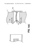 Method and Apparatus for the Treatment of the Intervertebral Disc Annulus diagram and image