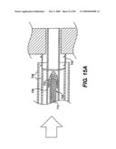 Method and Apparatus for the Treatment of the Intervertebral Disc Annulus diagram and image