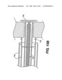 Method and Apparatus for the Treatment of the Intervertebral Disc Annulus diagram and image