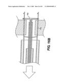 Method and Apparatus for the Treatment of the Intervertebral Disc Annulus diagram and image