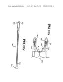 Method and Apparatus for the Treatment of the Intervertebral Disc Annulus diagram and image