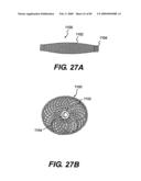 Method and Apparatus for the Treatment of the Intervertebral Disc Annulus diagram and image