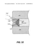 Method and Apparatus for the Treatment of the Intervertebral Disc Annulus diagram and image