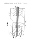 Method and Apparatus for the Treatment of the Intervertebral Disc Annulus diagram and image