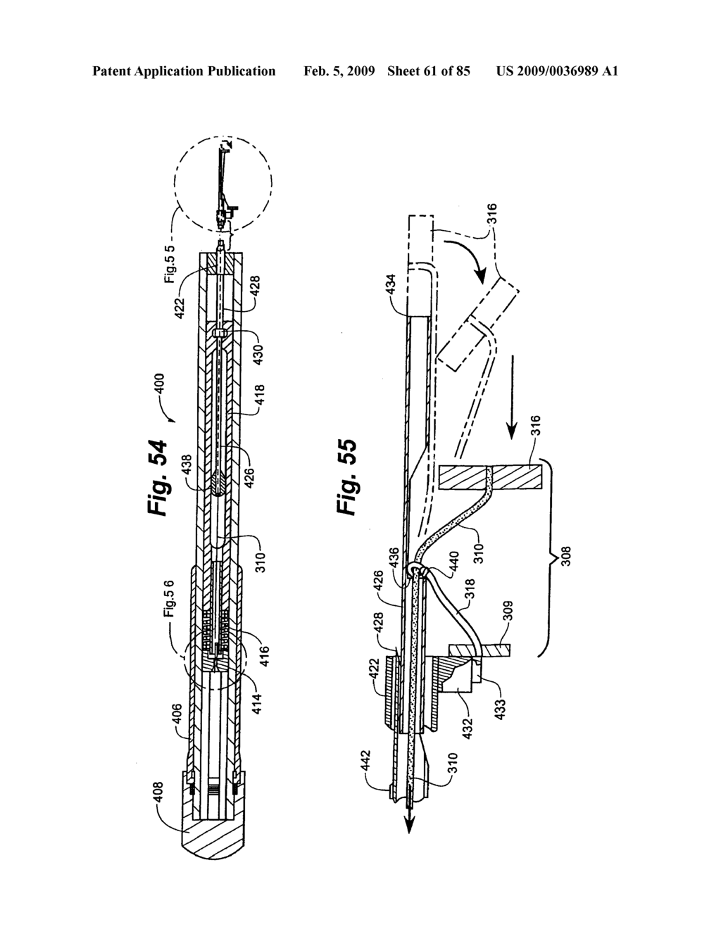 Method and Apparatus for the Treatment of the Intervertebral Disc Annulus - diagram, schematic, and image 62