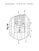 Method and Apparatus for the Treatment of the Intervertebral Disc Annulus diagram and image