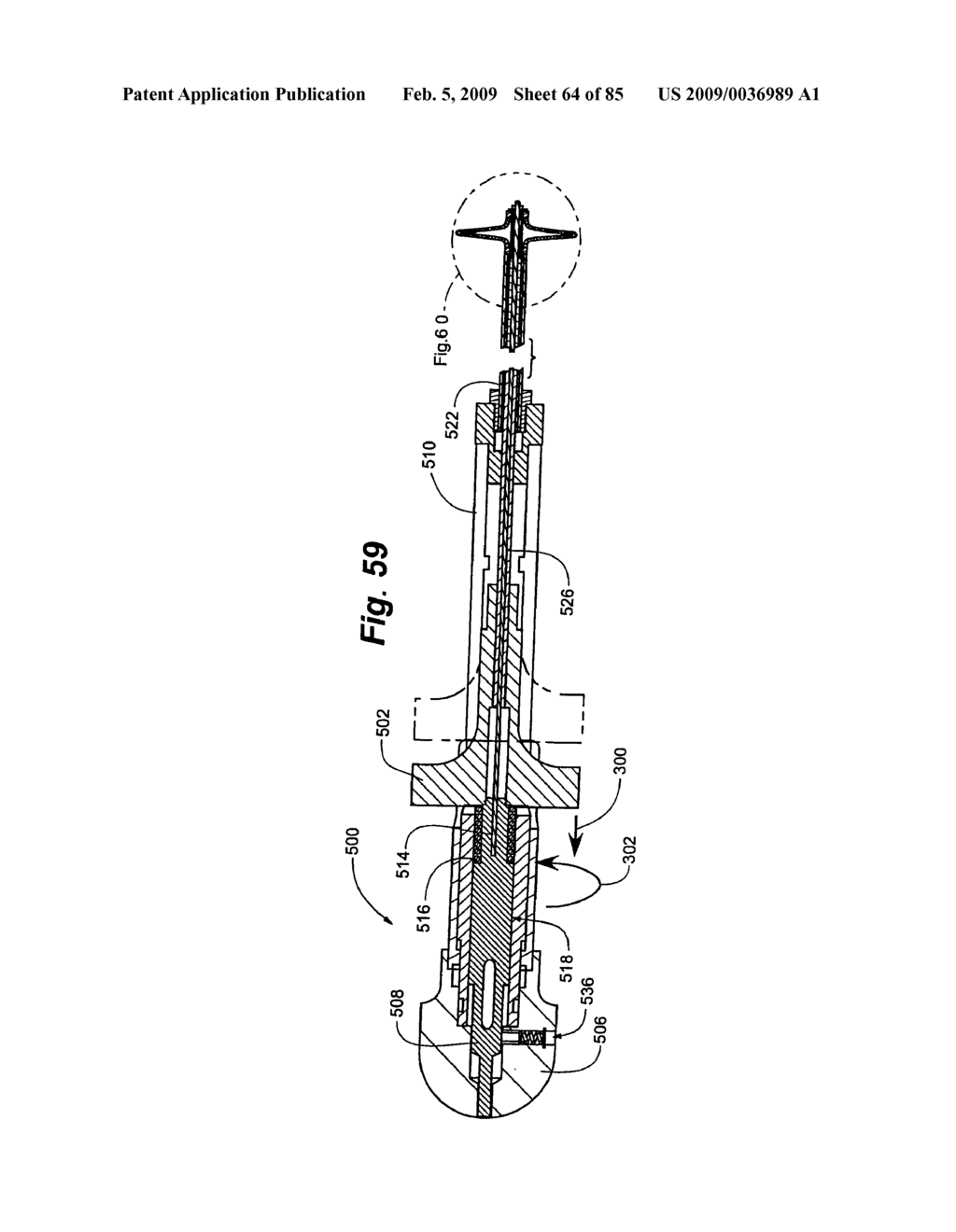 Method and Apparatus for the Treatment of the Intervertebral Disc Annulus - diagram, schematic, and image 65