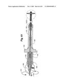 Method and Apparatus for the Treatment of the Intervertebral Disc Annulus diagram and image