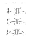 Method and Apparatus for the Treatment of the Intervertebral Disc Annulus diagram and image