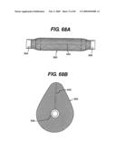 Method and Apparatus for the Treatment of the Intervertebral Disc Annulus diagram and image