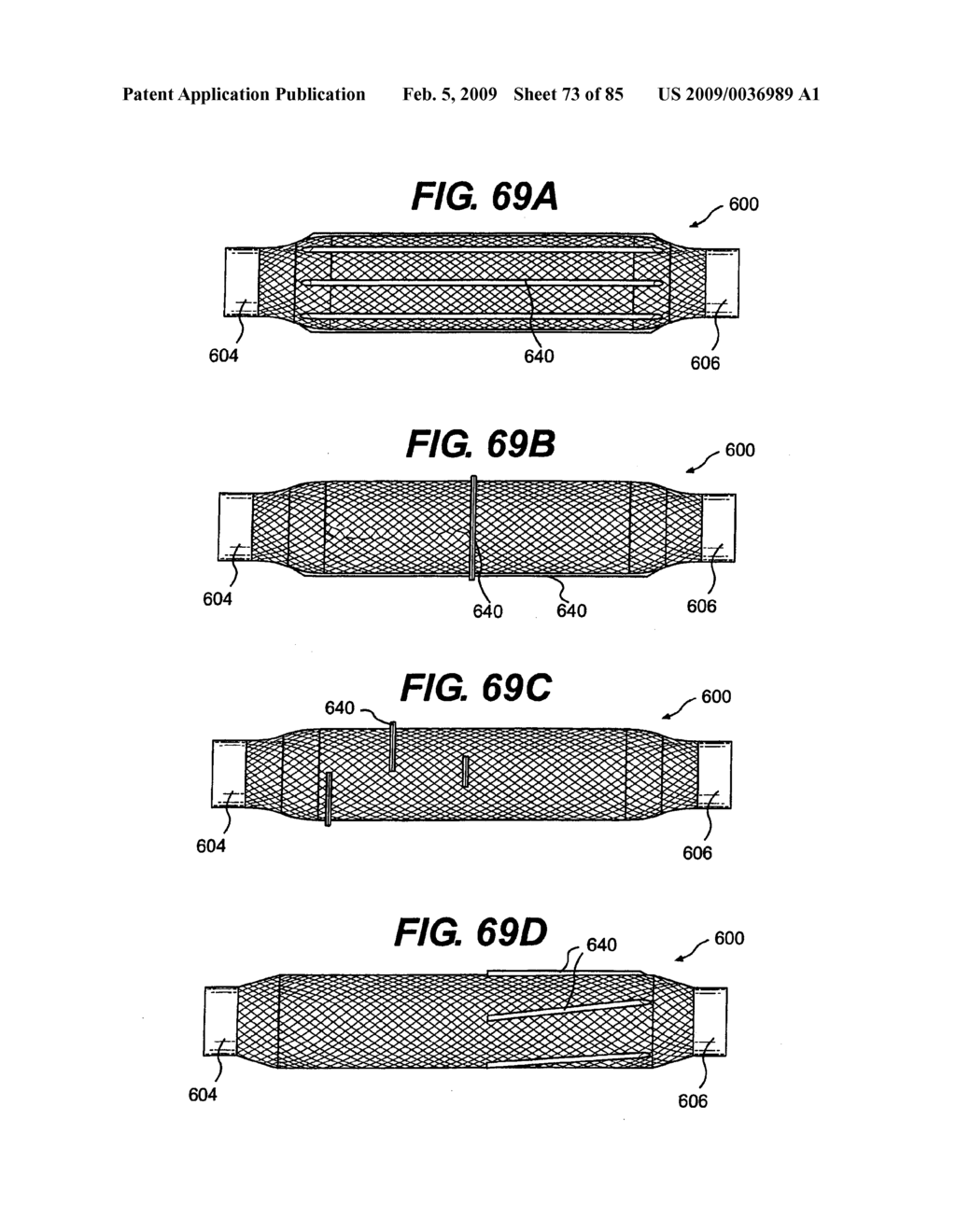 Method and Apparatus for the Treatment of the Intervertebral Disc Annulus - diagram, schematic, and image 74