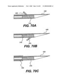 Method and Apparatus for the Treatment of the Intervertebral Disc Annulus diagram and image