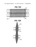 Method and Apparatus for the Treatment of the Intervertebral Disc Annulus diagram and image