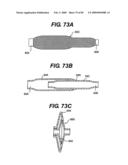 Method and Apparatus for the Treatment of the Intervertebral Disc Annulus diagram and image