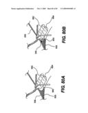 Method and Apparatus for the Treatment of the Intervertebral Disc Annulus diagram and image