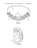 GOGGLE LENS ATTACHMENT SYSTEM AND METHOD diagram and image