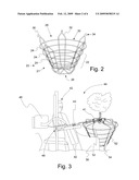 Tree Balling Method, System, and Wire Basket Used Therein diagram and image