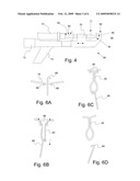 Tree Balling Method, System, and Wire Basket Used Therein diagram and image