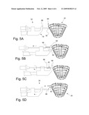 Tree Balling Method, System, and Wire Basket Used Therein diagram and image