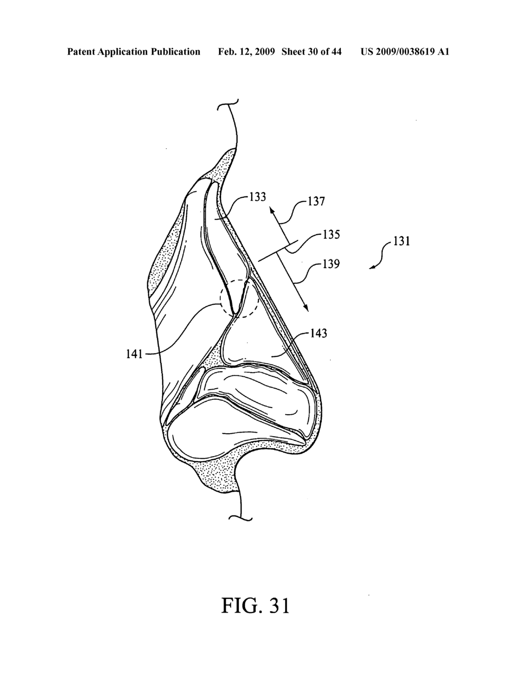 FULL FACE RESPIRATORY MASK WITH INTEGRATED NASAL INTERFACE - diagram, schematic, and image 31