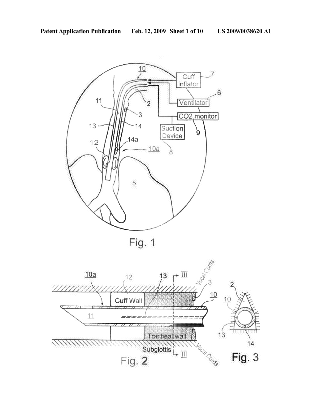 Endotracheal Tube and Intubation System Including Same - diagram, schematic, and image 02