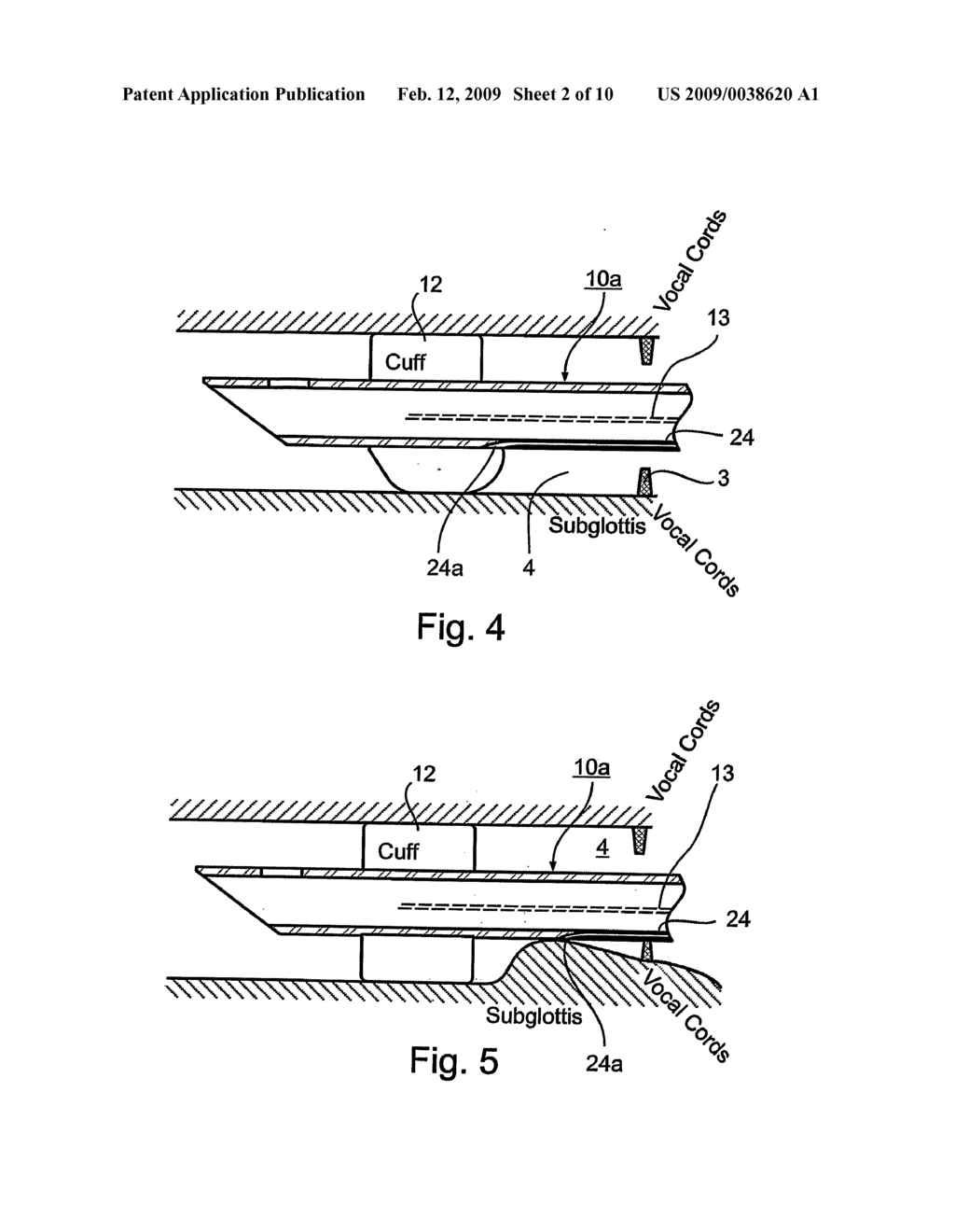 Endotracheal Tube and Intubation System Including Same - diagram, schematic, and image 03