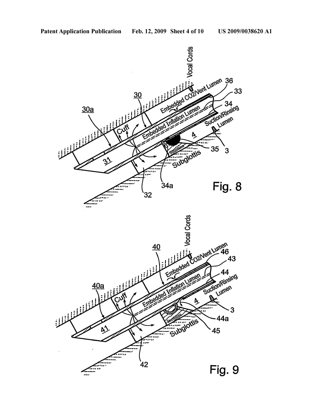 Endotracheal Tube and Intubation System Including Same - diagram, schematic, and image 05