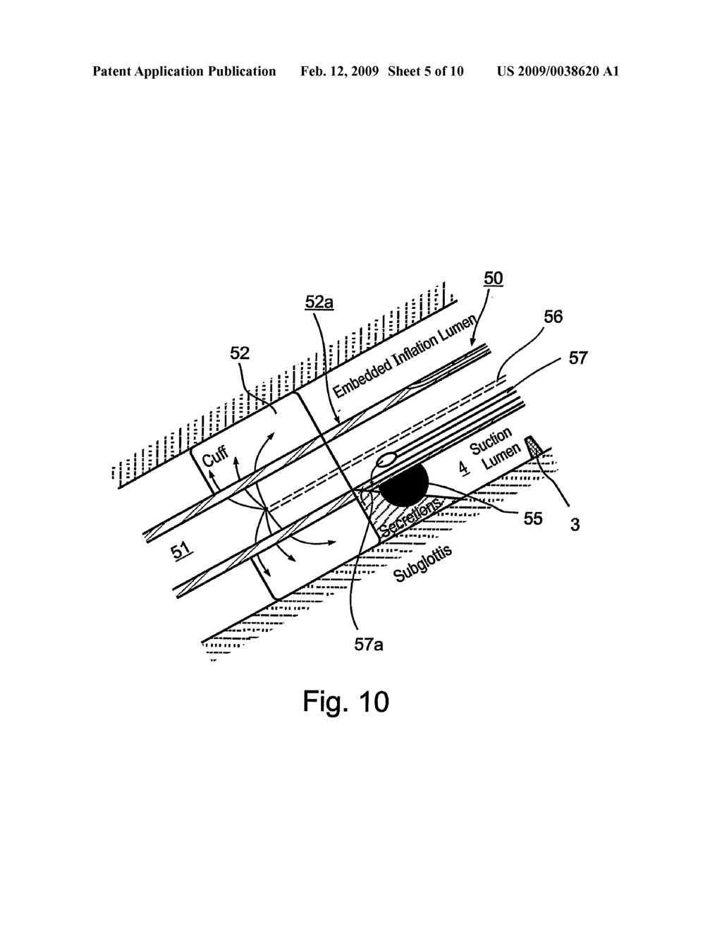 Endotracheal Tube and Intubation System Including Same - diagram, schematic, and image 06