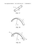 INDUCTIVE POWER TRANSFER SYSTEM FOR PALATAL IMPLANT diagram and image