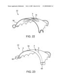 INDUCTIVE POWER TRANSFER SYSTEM FOR PALATAL IMPLANT diagram and image