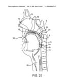 INDUCTIVE POWER TRANSFER SYSTEM FOR PALATAL IMPLANT diagram and image