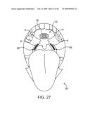 INDUCTIVE POWER TRANSFER SYSTEM FOR PALATAL IMPLANT diagram and image