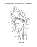 INDUCTIVE POWER TRANSFER SYSTEM FOR PALATAL IMPLANT diagram and image