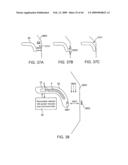 INDUCTIVE POWER TRANSFER SYSTEM FOR PALATAL IMPLANT diagram and image