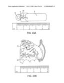 INDUCTIVE POWER TRANSFER SYSTEM FOR PALATAL IMPLANT diagram and image