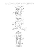 INDUCTIVE POWER TRANSFER SYSTEM FOR PALATAL IMPLANT diagram and image