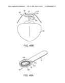 INDUCTIVE POWER TRANSFER SYSTEM FOR PALATAL IMPLANT diagram and image