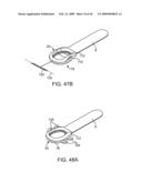 INDUCTIVE POWER TRANSFER SYSTEM FOR PALATAL IMPLANT diagram and image