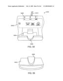 INDUCTIVE POWER TRANSFER SYSTEM FOR PALATAL IMPLANT diagram and image