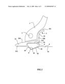 Locking Ring in an Assembly for Mounting a Tire on a Vehicle Hub diagram and image