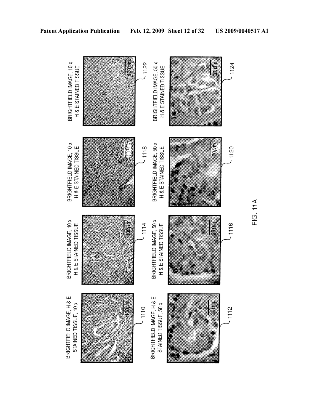 RAMAN DIFFERENCE SPECTRA BASED DISEASE CLASSIFICATION - diagram, schematic, and image 13